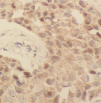 EAF2 Antibody