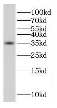 MAPRE1 Antibody