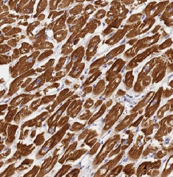 MAPRE3 Antibody