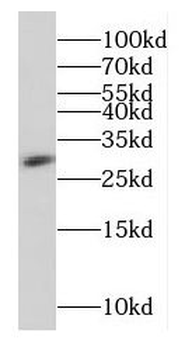 EBI3 Rabbit Polyclonal Antibody