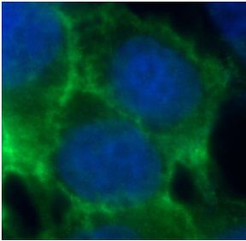 CDH1 Antibody