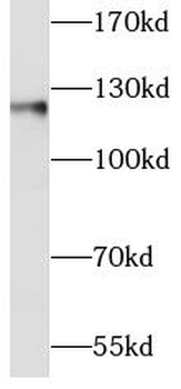 CDH1 Antibody