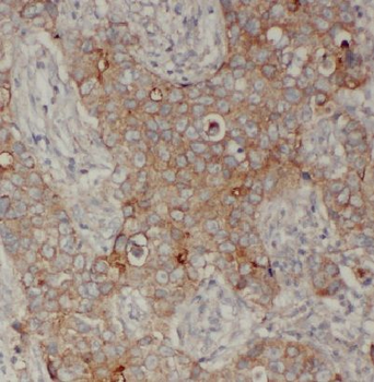 CDH1 Antibody
