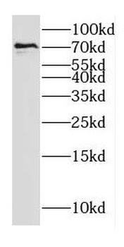 ECD Antibody