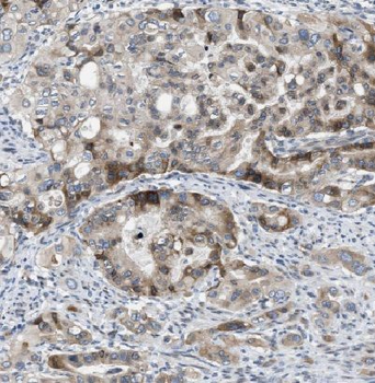 ECH1 Antibody