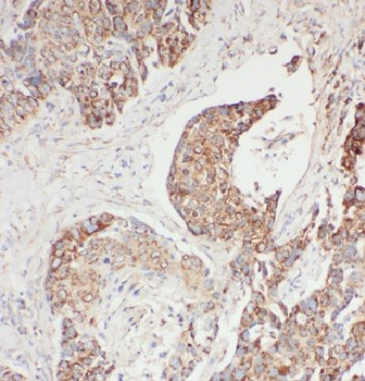 EDC4 Antibody