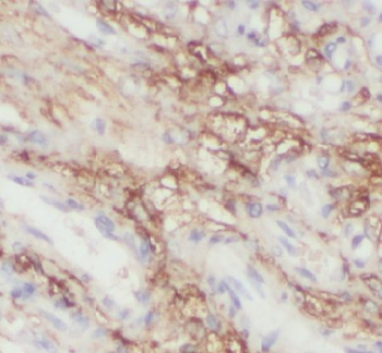 EDNRB Antibody