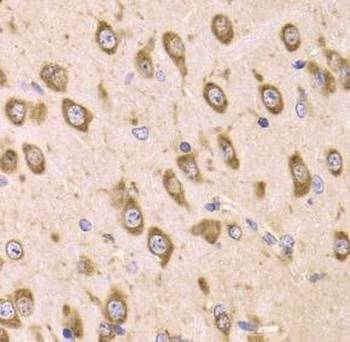 EEF1B2 Antibody