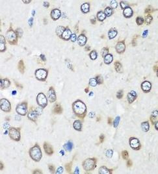 EEF1G Rabbit Polyclonal Antibody