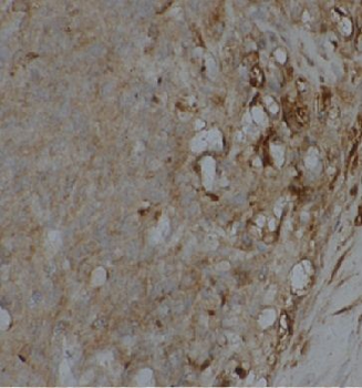 EEF2 Antibody