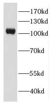 EFCAB5 Rabbit Polyclonal Antibody