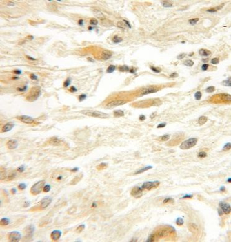 EFHD2 Antibody