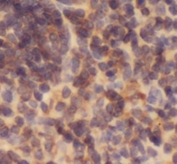 EFS Antibody