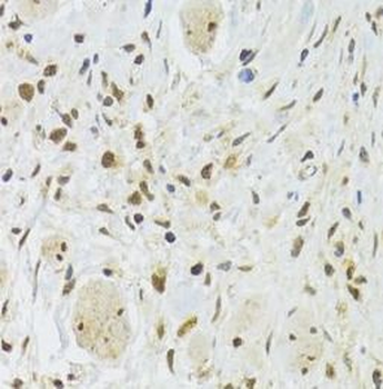 EFTUD2 Antibody