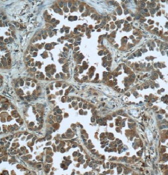 KIF11 Rabbit Polyclonal Antibody