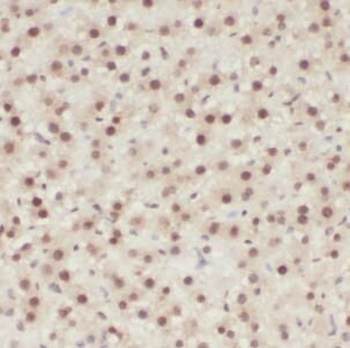 EGR1 Rabbit Polyclonal Antibody