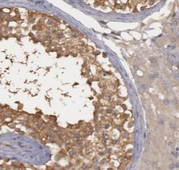 EHBP1 Antibody