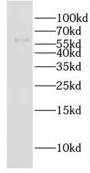EHD2 Antibody