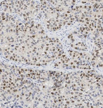 EID1 Antibody