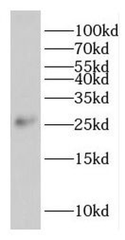 EIF1AD Rabbit Polyclonal Antibody