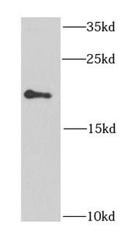 EIF1AY Antibody
