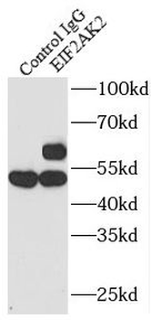 EIF2AK2 Rabbit Polyclonal Antibody