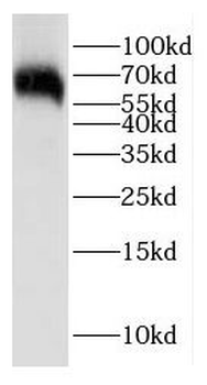 EIF2AK2 Rabbit Polyclonal Antibody