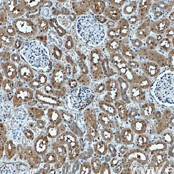 EIF2AK2 Rabbit Polyclonal Antibody