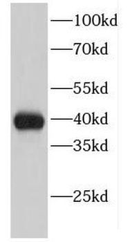 EIF2B2 Antibody