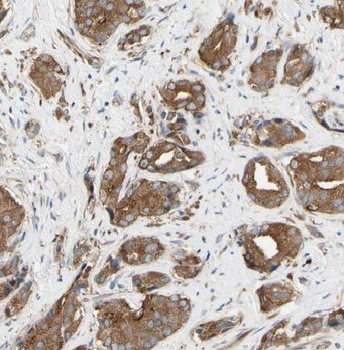 EIF2B3 Antibody