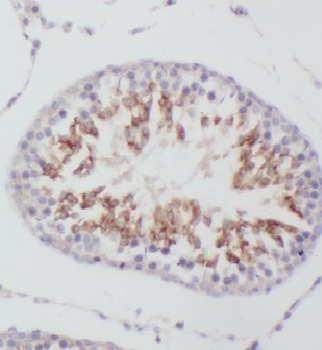 EIF2S2 Antibody