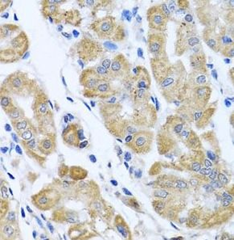 EIF2S3 Antibody