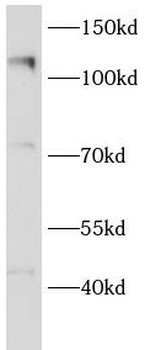 EIF3B Antibody