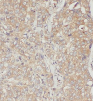 EIF3D Antibody