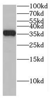 EIF3J Antibody