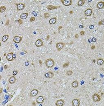 EIF4A2 Antibody