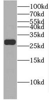 EIF4E2 Antibody