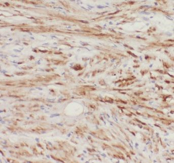 EIF4EBP2 Antibody