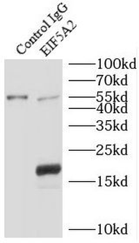 EIF5A2 Antibody