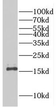 EIF5A2 Antibody