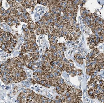 EIF5A2 Antibody