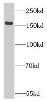 EIF5B Antibody