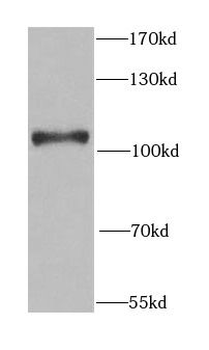 ELAC2 Rabbit Polyclonal Antibody