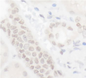 ELF1 Antibody