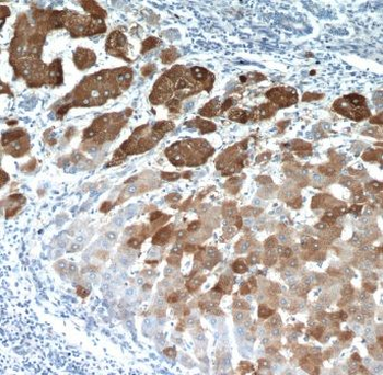 ELOVL6 Antibody