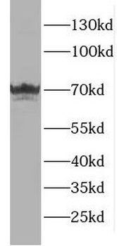 EMB Rabbit Polyclonal Antibody