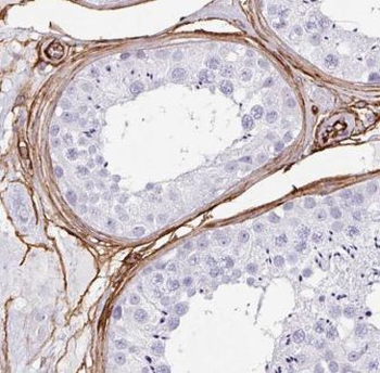 EMB Antibody