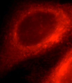 EML1 Rabbit Polyclonal Antibody