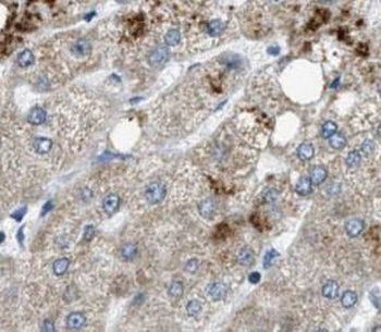 COL18A1 Antibody