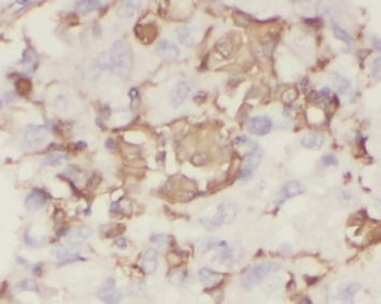 EDN1 Antibody